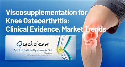 Viscosupplementation untuk Osteoartritis Lutut: Bukti Klinikal, Trend Pasaran